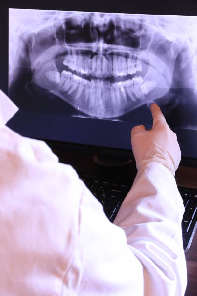 Best Emergency Dental Filling Replacement  in Memphis, MI