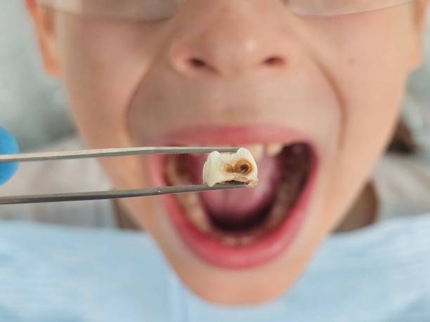Best Tooth Infection Emergency Dentist  in Memphis, MI