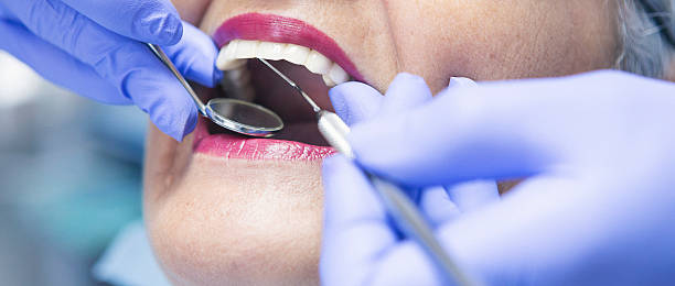 Best Chipped Tooth Repair Near Me  in Memphis, MI